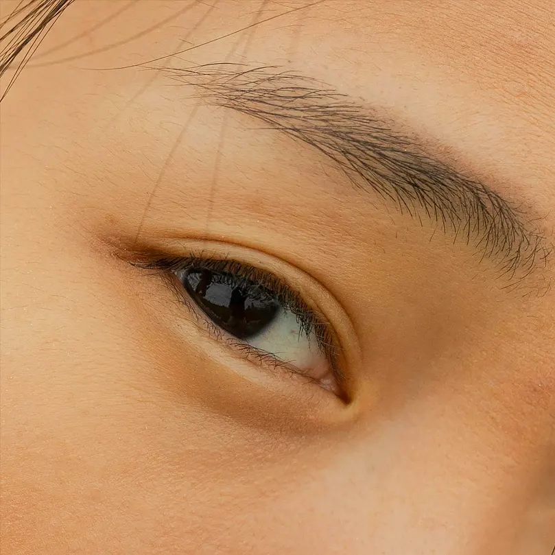 Otamme aidosti vastuun silmien laserleikkauksen lopputuloksesta. Vastuullisuus on toimintamallimme ydin.