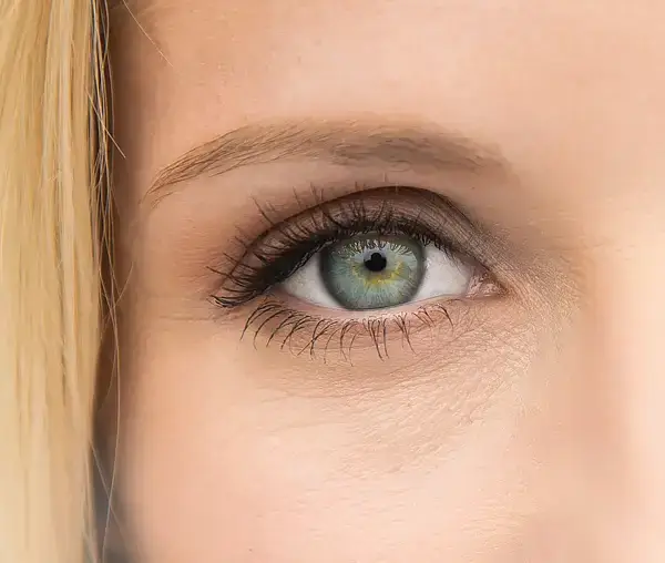 Silmien laserleikkaus: SMILE vai LASIK? Kumpi tekniikka sopii sinulle paremmin?